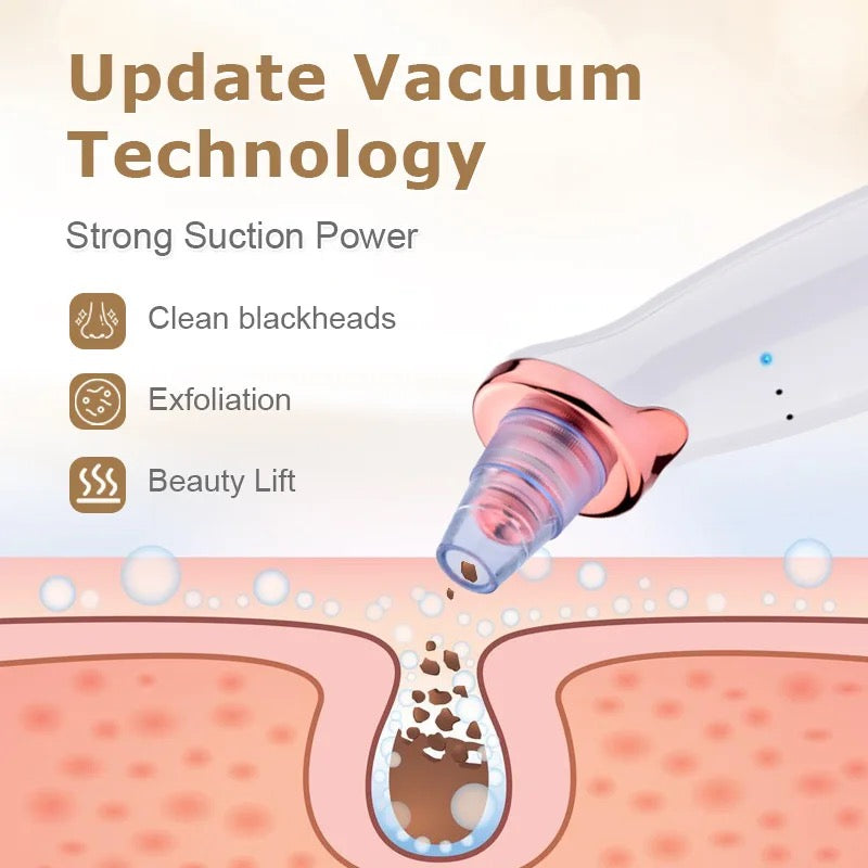 Blackhead Vacuum Pore Cleaner Blackhead Remover