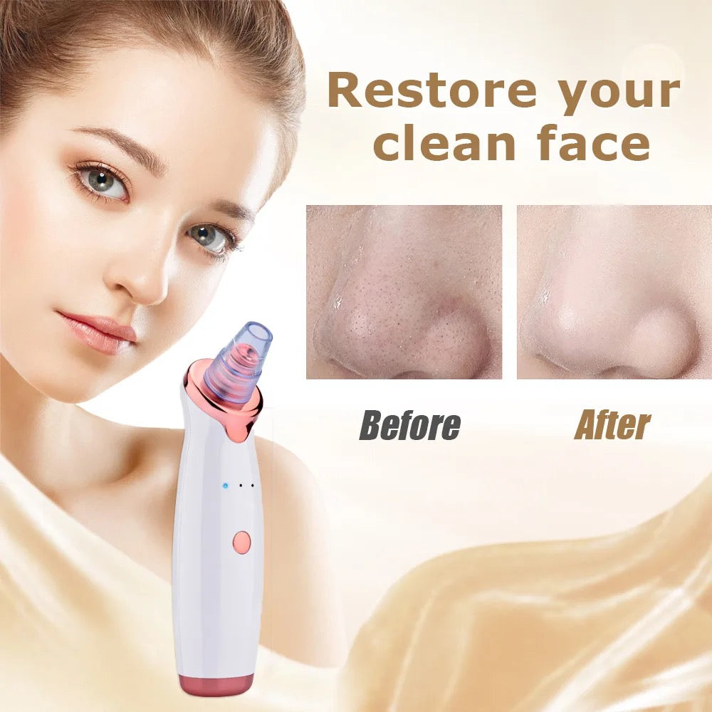 Blackhead Vacuum Pore Cleaner Blackhead Remover