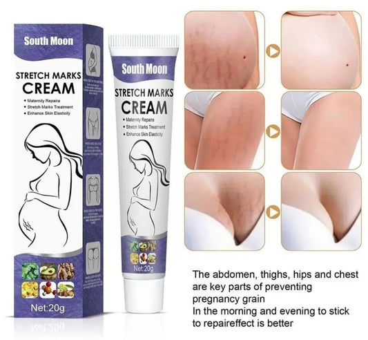 Stretch Marks Cream